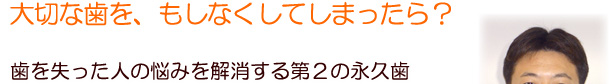 インプラント